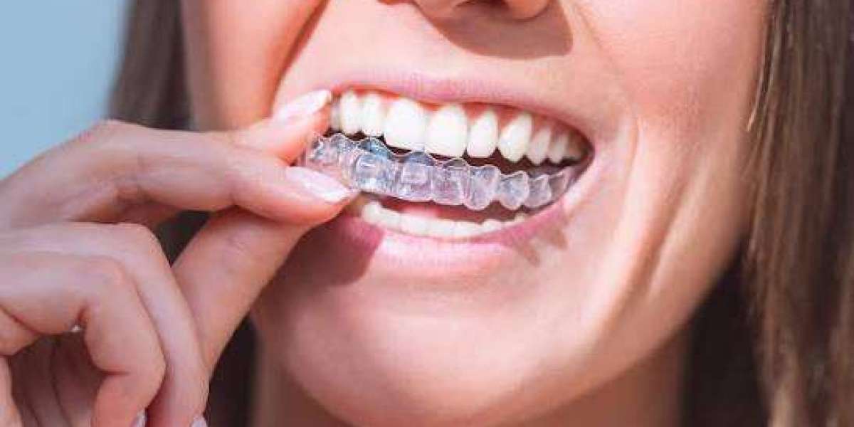 Invisalign Treatment for Natural-Looking Results