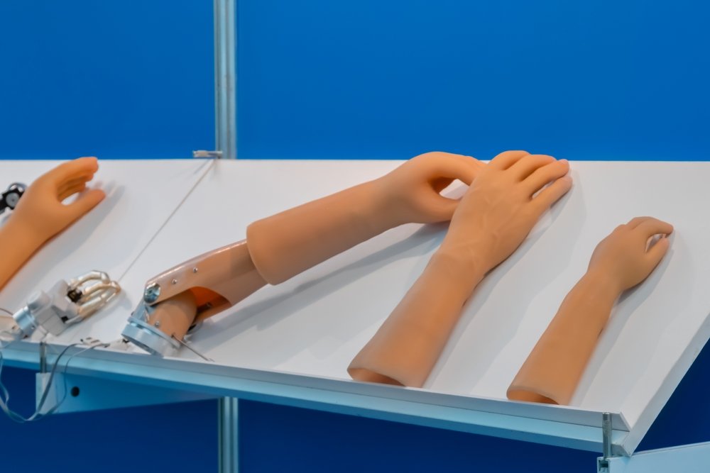 Best Artificial Limb Center in Punjab | United Limb Center Punjab