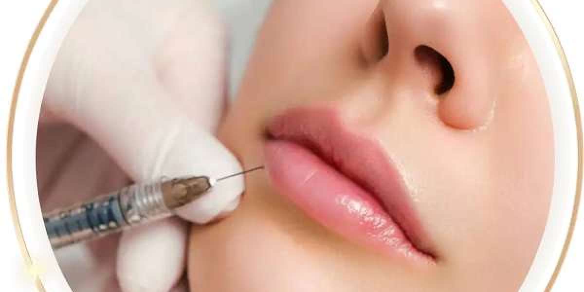 Are Lip Fillers FDA approved?