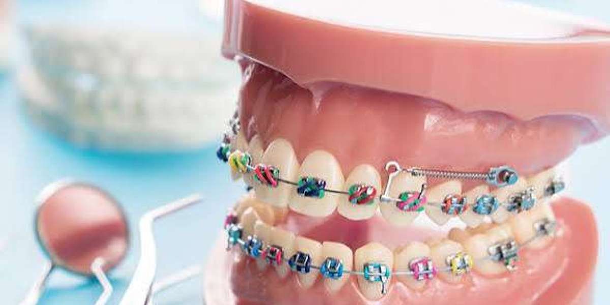 Global Orthodontics Market Size, Share & Forecast 2025–2035 | MarketGenics