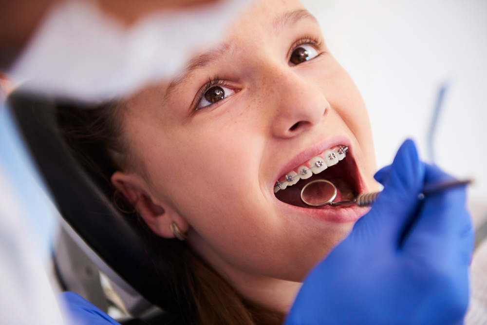 What Causes Tooth Decay in Children and How to Stop It Early – Vibe Writes