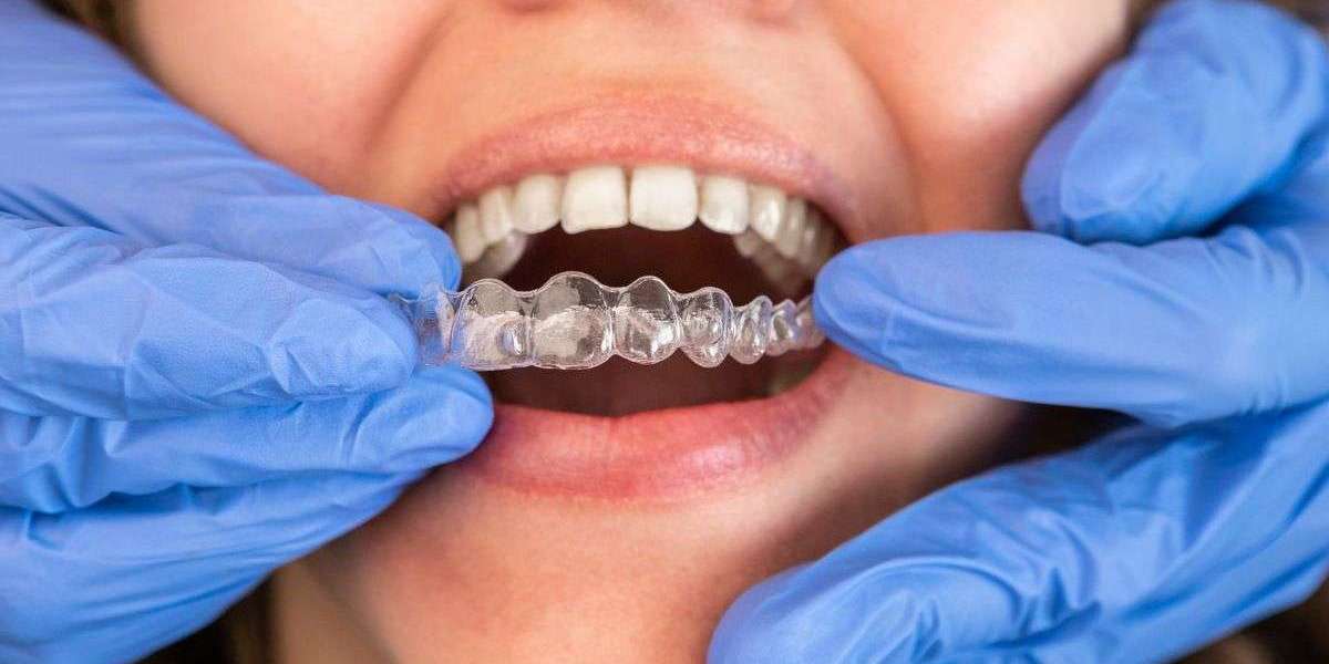 How Long Do Dental Retainers Last?