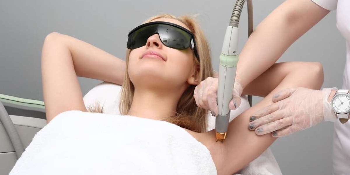 Which Laser Hair Removal technology is best