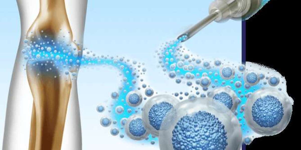 How does Stem Cells Therapy work?