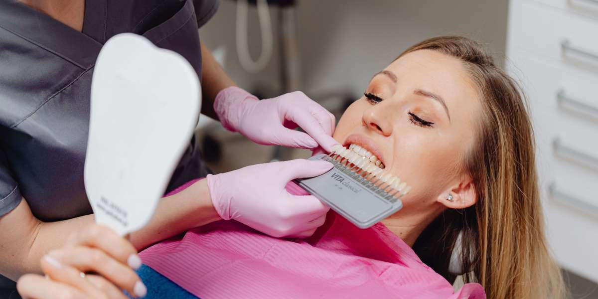 Veneers Brisbane: Understanding the Treatment Process