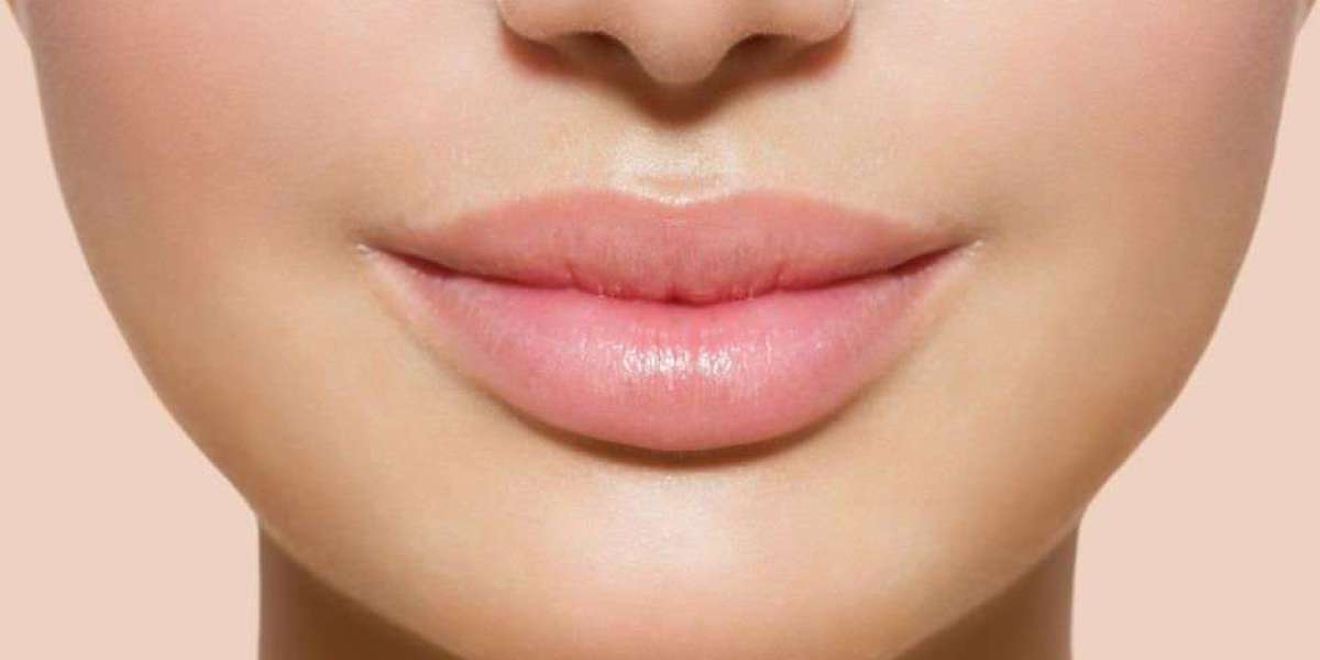 Botox Lip Flip Aftercare: Do’s and Don’ts
