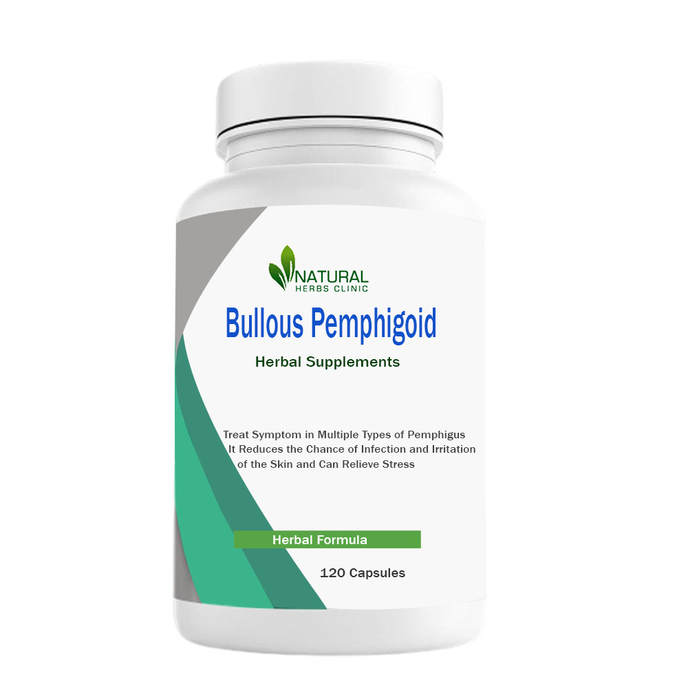 Herbal Treatment for Bullous Pemphigoid | Natural Herbs Clinic