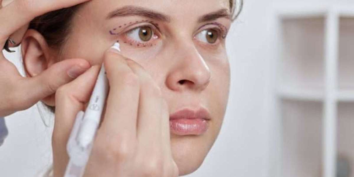 Is Eyelid Surgery in Islamabad Worth Considering for Heavy Eyelids?