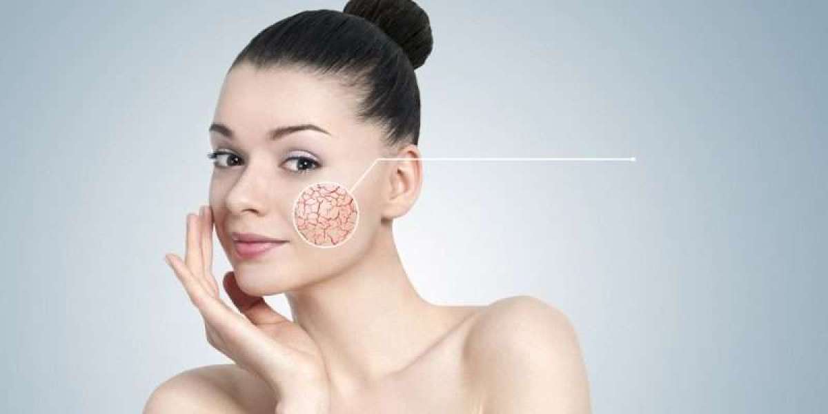 How does Facial Capillaries Treatment work?