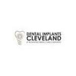 dentalimplantscleveland