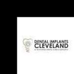 dentalimplantscleveland
