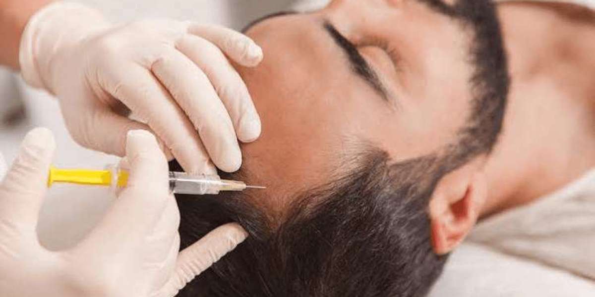 GFC Hair Treatment: Myths, Facts, and Patient Expectations