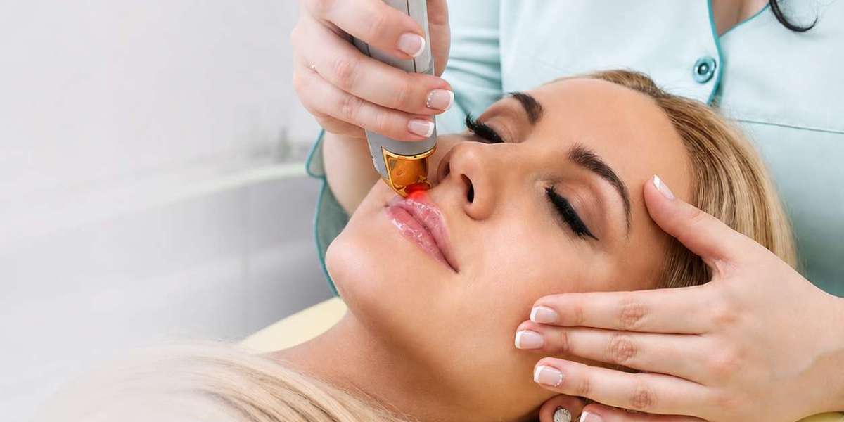 Facial Laser Hair Removal Cost at Glamorous Aesthetic Clinic