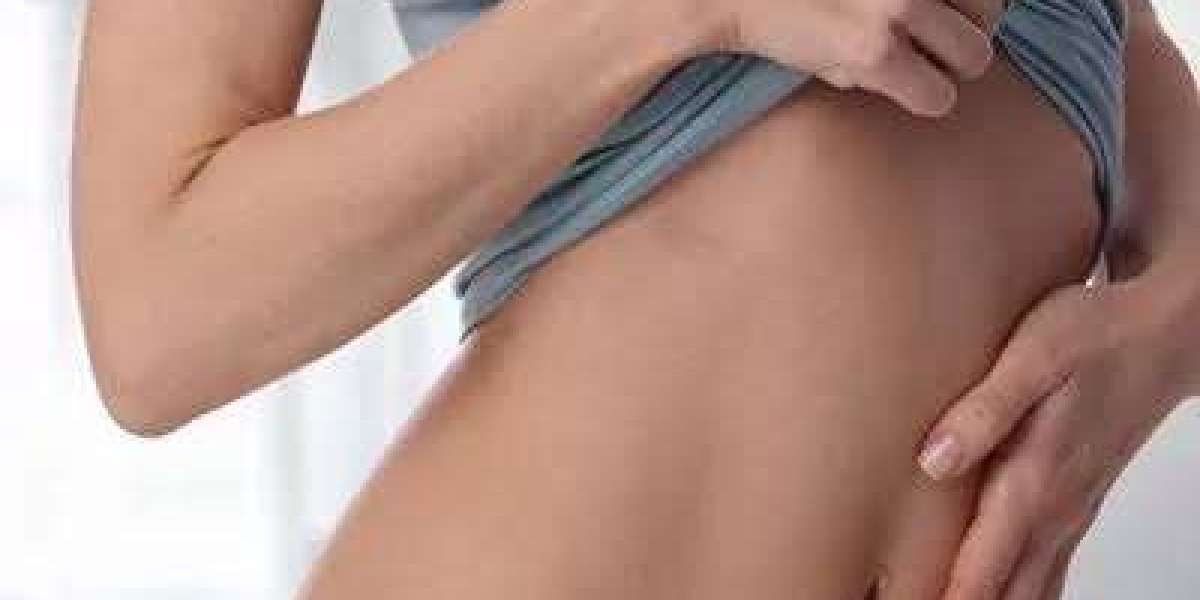 Why Choose Liposuction in Islamabad for Body Contouring?