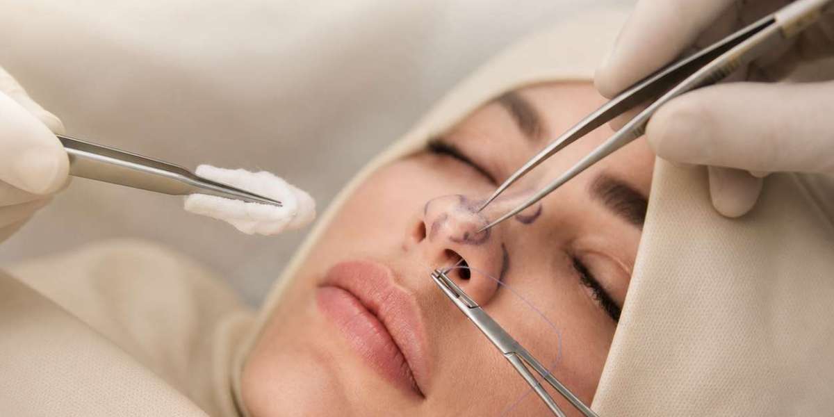 Can Rhinoplasty Give Me a Smaller Nose?
