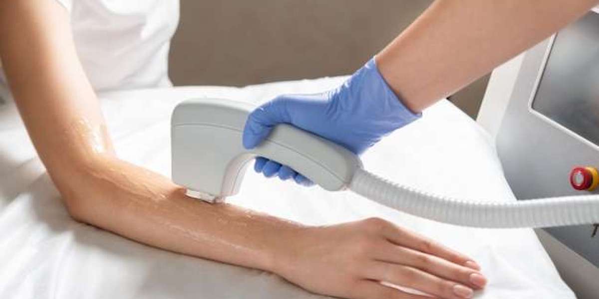 Top Clinics for Laser Hair Removal: What Should You Compare?