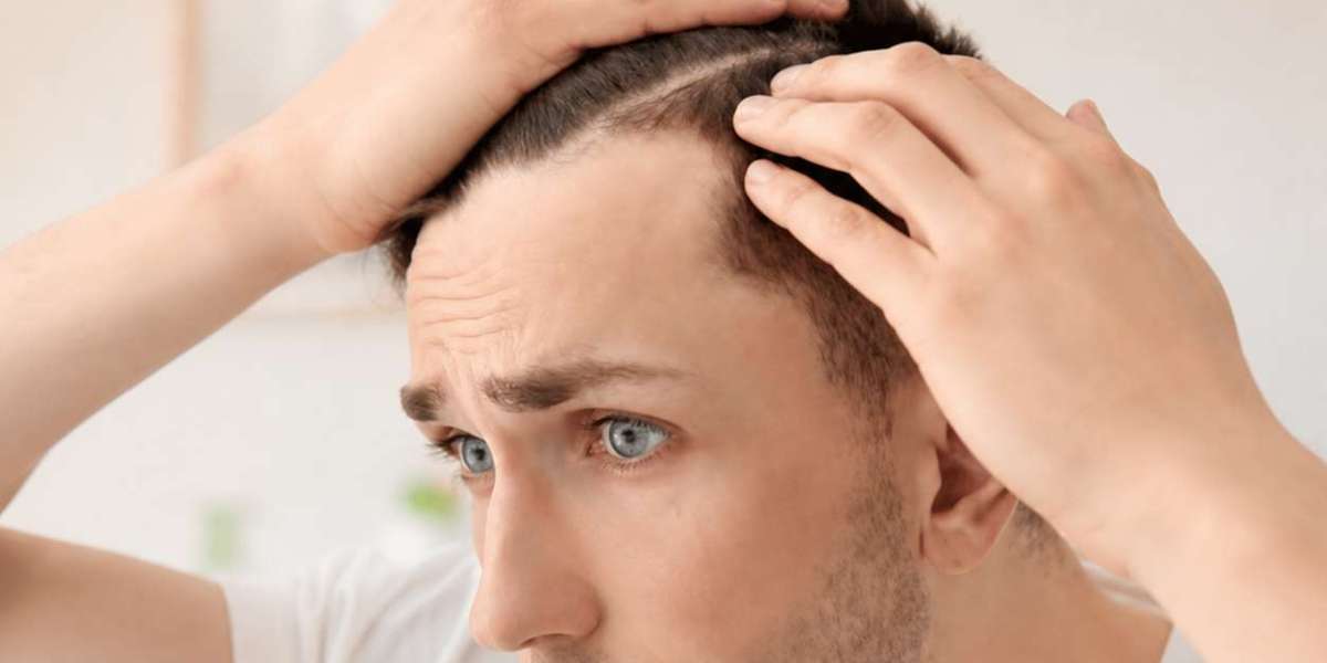 How Can You Stop Hair Loss with Professional Treatment in Islamabad?