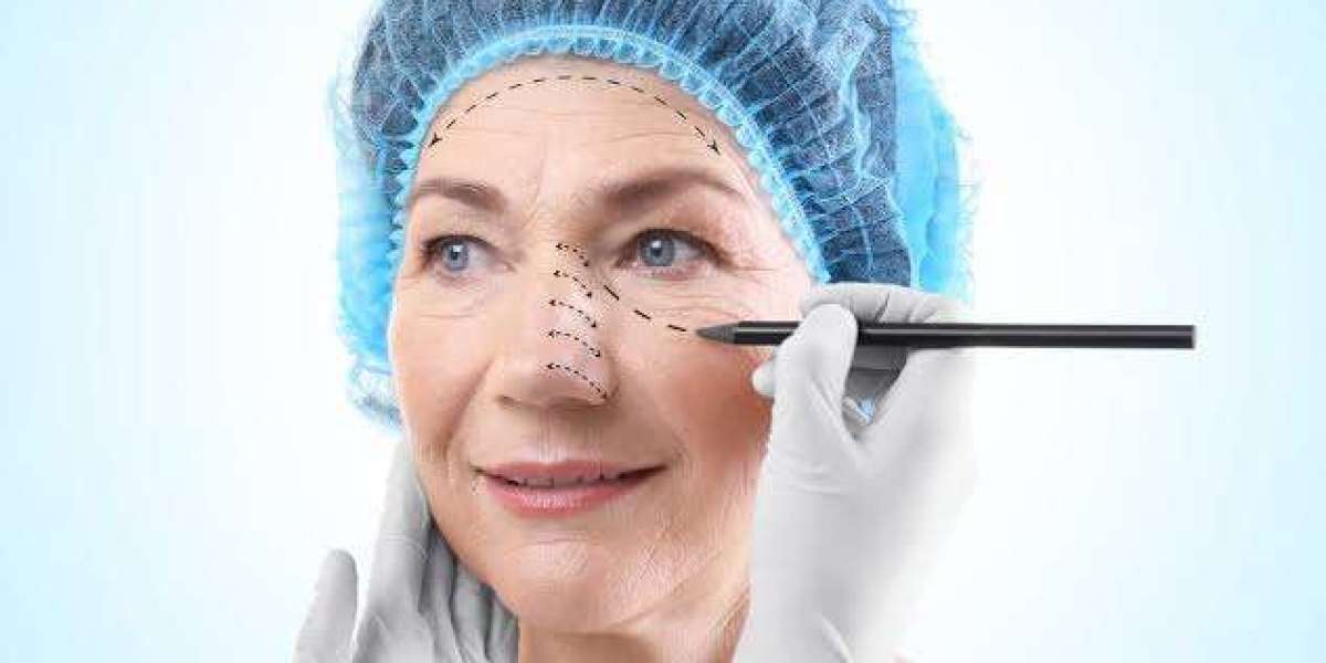 Is Eyelid Surgery in Islamabad Safe for People With Dry Eyes?
